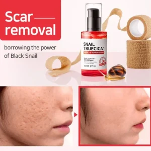 Snail Truecica Miracle Repair Serum – Korea | 50ml